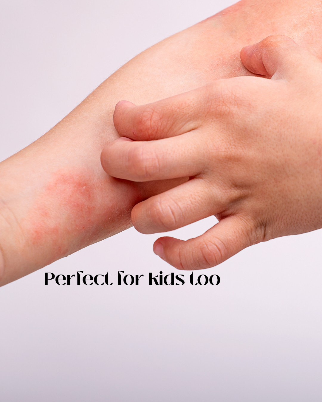 Calendula Balm - Image 5